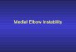 Medial Elbow Instability - · PDF fileClassic story is medial elbow pain in late ... +/- Positive Tinel’s sign over cubital tunnel ... –Placement of graft within a bony tunnel