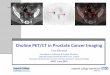 Choline PET/CT in Prostate Cancer Imaging - · PDF file11.02.2015 · Choline PET/CT in Prostate Cancer Imaging Tara Barwick Consultant in Radiology & Nuclear Medicine, Imperial College