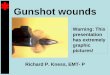 Warning: This presentation has extremely graphic  · PDF fileGunshot wounds Richard P. Kness, EMT- P Warning: This presentation has extremely graphic pictures!