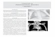 CHAPTER 54 Mediastinal Masses - · PDF fileDue to the variety of mediastinal masses, ... ectopic thyroid and malignancies of adipose tissue, ... Institution Department of Paediatric