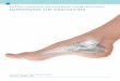 EXTRA-OSSEOUS TALOTARSAL STABILIZATION: NARROWING THE INDICATIONS · PDF file · 2016-12-29Extra-Osseous TaloTarsal Stabilization: Narrowing the Indications Introduction Sinus tarsi