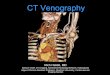 CT Venography - Stanford Universityhallett/UE_CTV_2017/Upper...Introduction • CT venography (CTV) is a technique targeted to assess venous anatomy, determine venous patency & delineate