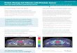 Prostate Cancer - ProCure Proton Therapy · PDF file Proton Therapy for Patients with Prostate Cancer Talk to your doctor about how proton therapy can help. Precision Therapy. Fewer