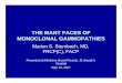 THE MANY FACES OF MONOCLONAL · PDF fileTHE MANY FACES OF MONOCLONAL GAMMOPATHIES ... • Ref. to me for monoclonal gammopathy IgGL ... • 1.Presence of a Monoclonal antibody : IgG,