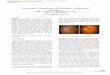 Automatic Detection of Exudates in Retinal Images · Diabetic retinopathy is a major cause of blindness. ... stages, treatment can slow ... the image is used in the automated analysis