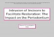 Intrusion of Incisors to Facilitate Restoration: The … of Incisors to Facilitate Restoration: The Impact on the Periodontium Names of Investigators Date Note: This is a sample Eoster