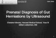 Prenatal Diagnosis of Gut Herniations Herniations by ...eradiology.bidmc.harvard.edu/LearningLab/gastro/westra.pdf · Prenatal Diagnosis of Gut Herniations Herniations by Ultrasound
