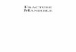 FRACTURE MANDIBLE - Add docshare01.docshare.tips to …docshare01.docshare.tips/files/28800/288006760.pdf · Rajesh R Yadav MS (ENT) DORL FCPS Assistant Professor Rajawadi Hospital