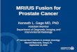 MRI/US Fusion for Prostate Cancer - Moffitt Cancer … Fusion for Prostate Cancer Kenneth L. Gage MD, PhD Assistant Member Department of Diagnostic Imaging and Interventional Radiology