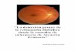 “La detección precoz de la retinopatía diabética ... · capilar y de la rotura de la barrera hematorretiniana, con salida de los componentes del plasma hacia la retina. Los microaneurismas