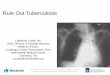 Rule Out Tuberculosis - American College of Physicians and Case Western Reserve University, affiliated since 1914, partners in advancing patient care through research and teaching