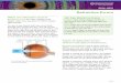 Refractiv rrors - Eye Sight And Surgery · Refractiv rrors 214–21 1 of 4 Cornea Lens Light rays Retina Light is focused onto the retina In a normal eye, ... Refractive surgery