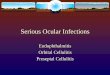 Serious Ocular Infections - diabetic retinopathy Ocular... · Inflammation of one or more coats of the eye and ... every two gram-positive infections. Staphylococcus aureuswas the