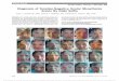 Diagnosis of Tensilon-Negative Ocular Myasthenia Gravis …vision.ucsf.edu/hortonlab/publications/GutermanBotelhoHorton(2016).pdf · levels, and a Tensilon test were negative. On