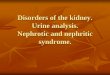 Disorders of the kidney. Urine analysis. Nephrotic and ...semmelweis.hu/belgyogyaszat2/files/2016/04/20160421_FOK_IV_EN... · Disorders of the kidney. Urine analysis. Nephrotic and