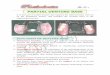 prosthodontics (removable partial dentures) - … · It is that part of partial denture that supports the artificial teeth, and rest on the foundation tissues, and transfers the occlusal