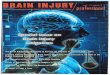 departments - nmcdn.io · collision is diagnosed with a concussion and whiplash, ... traumatic headaches" attributable to the concussion the patient suffered a rwo months ago