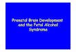 Prenatal Brain Development and the Fetal Alcohol Syndrome · pak/development.ppt More than 25 syndromes resulting from abnormal ... Neurulation Ðspina bifida and anencephaly Ð increased