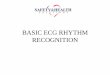 BASIC ECG RHYTHM RECOGNITION - CPR Classes, … · SINUS TACHYCARDIA •Rounded P waves •Narrow QRS •Normal T wave •Regular rate •Rate above 100 and below 150 •If Rate exceeds