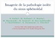 Imagerie de la pathologie isolée du sinus sphénoïdalpe.sfrnet.org/Data/ModuleConsultationPoster/pdf/2013/1/... · 2013-11-28 · Imagerie de la pathologie isolée ... Etudier l’apport
