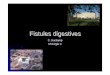Fistules digestives - kayinamura.free.frkayinamura.free.fr/docs/cours/fistuledigestive.pdf · Infection intra abdominale! Distention intestinale! ... Crohn, radiques, tumorales 