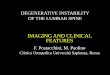 DEGENERATIVE INSTABILITY OF THE LUMBAR … DICEMBRE... · MRI criteria of degenerative instability of the lumbar spine ... •Modic changes of the subchondral bone •Increased joint