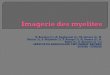 N. Benzina (1), H. Zaghouani (1), M. Limem (1), N. …pe.sfrnet.org/Data/ModuleConsultationPoster/pdf/2013/1/3ae0e0b4-4f... · d'une myélite en IRM. ... myélopathie aiguë ou chronique,