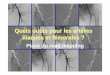 Quels outils pour les artères - i-MEET CONGRESS 2018meetcongress.com/Archives_site2008/pdf/meet2008/SATURDAY JUNE … · L’artériographie aorto-membres inférieurs Protocole Globale