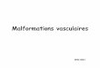 Malformations vasculaires - college-chirped.fr · Classification Malformations vasculaires Malformations Flux lent Malformations Flux rapide Malformations capillaires Malformations