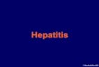 Schulvortrag Final 25.6.03.ppt [Schreibgesch.tzt] · • Spätfolgen einer chronischen Hepatitis B-Leberzirrhose (bindegewebige Umgestaltung des Lebergewebes)-Leberkarzinom (Leberkrebs)
