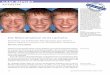 CASE REPORT - oliverbrix-training.de Artikel... · Die Rekonstruktion eines Lächelns Ästhetische und funktionelle Rekonstruktion eines Dentino-genesis-imperfecta-Patienten mit Lithiumdisilikat-Glaskeramik