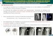 HOSPITAL DE DÉNIA 2016 PDF/P40.pdf · • RX = Artrosis glenohumeral postraumática • RM Hombro= Osteoartrosis glenohumeral con remodelación