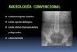 ANATOMÍA RADIOLÓGICA DEL HÍGADO - …seram2010.seram.es/modules/posters/files/anatoma_radiolgica_1.pdf · Cuadrante superior derecho. ... Nace del tronco celíaco junto con la