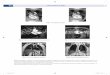 Figs. 1 y 2: IRM del corazón - amolca.com.co · 472 Atlas Práctico de IRM IRM del corazón: La IRM es una técnica obtención rápida de imágenes para las enfermedades cardíacas