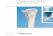 LCP Medial Proximal Tibial Plate 4.5/5.0. Part of the ... Mobile/Synthes International...  LCP Medial
