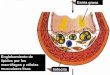 Englobamiento de lípidos por los macrófagos y células ... · colesterol a travÉs de las hdl ... interfiere en el aclaramiento de restos celulares por los macrÓfagos ... (gc/ms)
