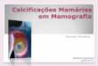 Calcificações Mamárias em Mamografiaclinicauniversitariaradiologia.pt/tematica/Calcificacoes_Mamarias... · lineares, em fios, junto à parede torácica ... C À periferia da mama,