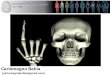 Apresentação do PowerPoint fileNeurocrânio – ossos realcionados ao encéfalo. Viscerocrânio – ossos relacionados a face, respiração, digestão