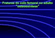 Fraturas do colo femoral no adulto osteossínteseortobook.com.br/.../24/1349045881-Fraturasdocolofemoralnoadulto.pdf · a redução e estabilização dos fragmentos durante o 