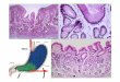 Parietali - HCL - .Pilorica Intestinale Cellule ciliate Spesso associata a distruzione delle ghiandole