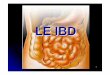 LE IBD - omeoweb.comomeoweb.com/wordpress/wp-content/uploads/2016/06/IBD.pdf · dolore pi ù intenso localizzato in fossa iliaca dx, presenza di massa palpabile, febbre e leucocitosi,