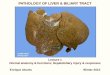 PATHOLOGY OF LIVER & HEPATOBILIARY SYSTEMpeople.upei.ca/eaburto/Liver1/Liver-L1-15.pdf · PATHOLOGY OF LIVER & BILIARY TRACT ... Robbins and Cotran Pathologic Basis of Disease (2010),