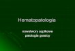 W Û^² Ü¼ ÛöP cÈ«Ð!µ = 'Îê Ópatomorfologia-cmuj.pl/sites/default/files/Hematopatologia_TEKST... · złożony kariotyp, monosoma 5 i 7. ... klonalny rozrost nowotworowy