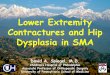 Lower Extremity Contractures and Hip Dysplasia in .Lower Extremity Contractures and Hip Dysplasia