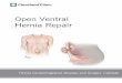 Open Ventral Hernia Repair - clevelandclinic.org · A ventral hernia is a hernia that occurs at any location along the midline (vertical center) of the abdomen wall. There are three