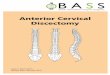 Anterior Cervical Discectomy Nerve root Bone Disc protrusion compressing the nerve root Spinal cord Page 4 About the operation The surgery called cervical discectomy is performed to