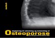 96259 DKMS Osteoporose - endocrinology.dk · struktur, herunder knoglernes geometri. 2.3. Molekylærbiologiske mekanismer I løbet af de seneste år er der gjort store fremskridt