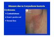 Erythrasma - gmch.gov.in lectures/skin/Bacterial_2.pdf  Staphylococcal Scalded Skin Syndrome (Ritterâ€™s