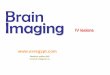 Brain Imaging - The Scientific Society of Radiology Imaging IV lesions Mamdouh mahfouz MD mamdouh.m5@gmail.com ssr Intraventricular lesions Ependymoma Choroid plexus papilloma Other