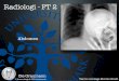 Radiologi - FT 2 - sdu.dk · Radiologi Fri luft Stående Ileus - SBO Tilstand hvor tarmpassagen er hindret Paralytisk ileus Tarmperistaltikken er lammet, som regel følge af peritonit